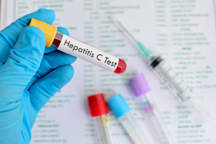 British Public Are Unaware Of Hepatisis C And Should Get Free Testing