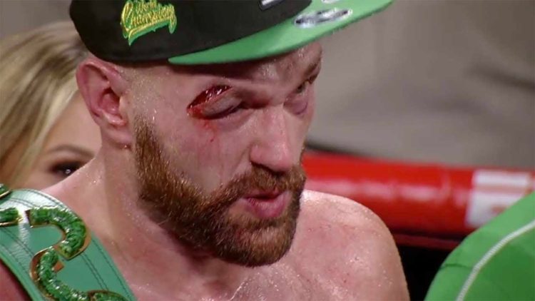 Tyson Fury’s Warrior Heart Saved Him From Defeat