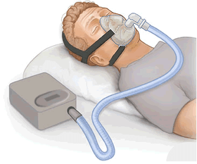 Alternative Devices For Ventilation Used In Hospitals Can Spread Covid-19 Virus