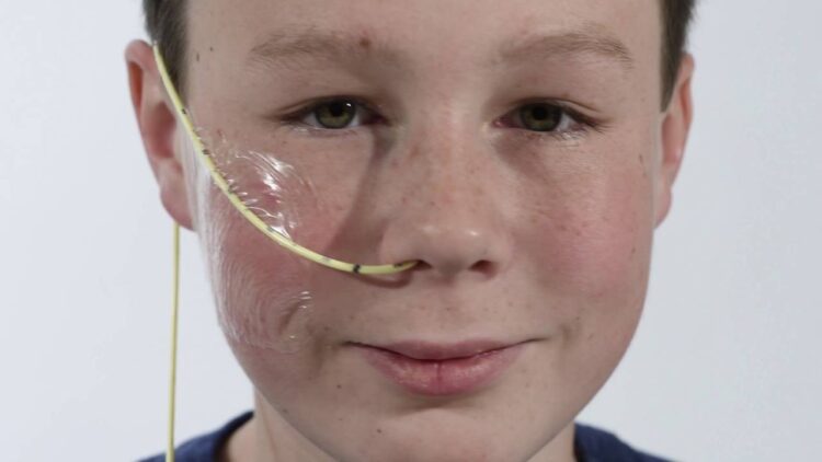 Feeding Tubes Were Mistakenly Inserted Into Patients Lungs For Six Month Period