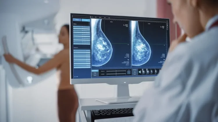 Queen Mary University Researchers say Breast Screening Is Not Overdiagnosed In The Uk
