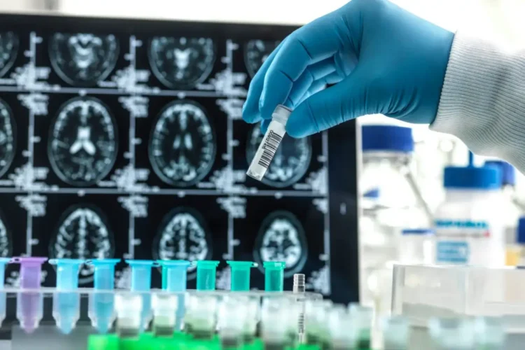 Doctors Hail New Medicine Capable Of Curing Alzheimers Disease