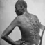 'The Scourged Back', an 1863 photo of a formerly enslaved man named 'Peter', which solidified public support for the abolition of slavery (William D. McPherson and J. Oliver (public domain))