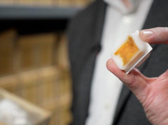 Ancient tumours offer clues to rising bowel cancer in young adults