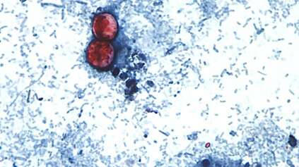 Michigan’s Cyclospora Outbreak Sparks a Race to Find Source