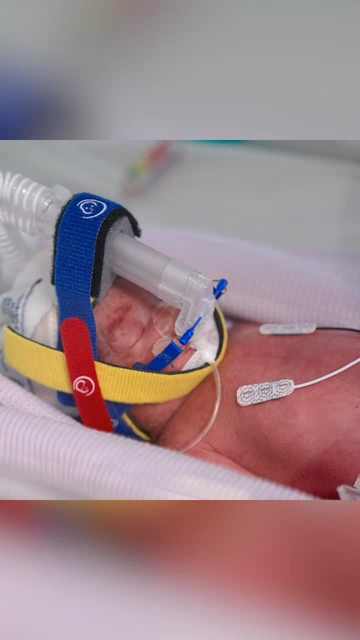 Australian Mum Gives Birth To Rare Quadruplets In Rare Twist Of Nature
